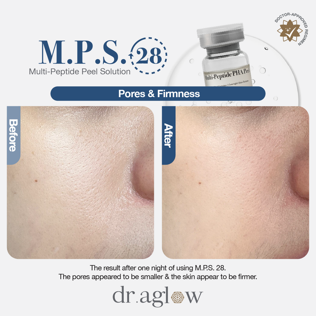 M.P.S. 28 (Single Vial)